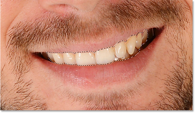 photoshop select teeth