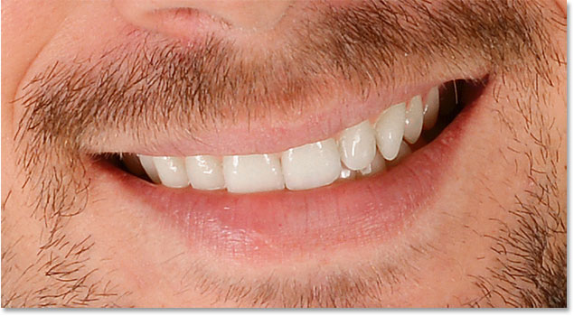 photoshop teeth color removed