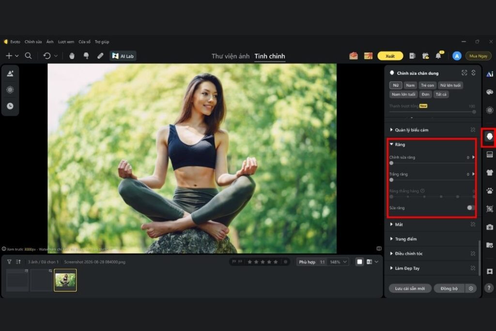 chỉnh răng đẹp tự nhiên