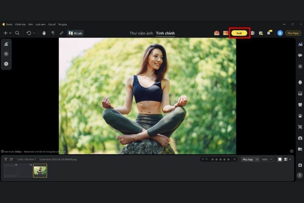 chỉnh răng đẹp tự nhiên