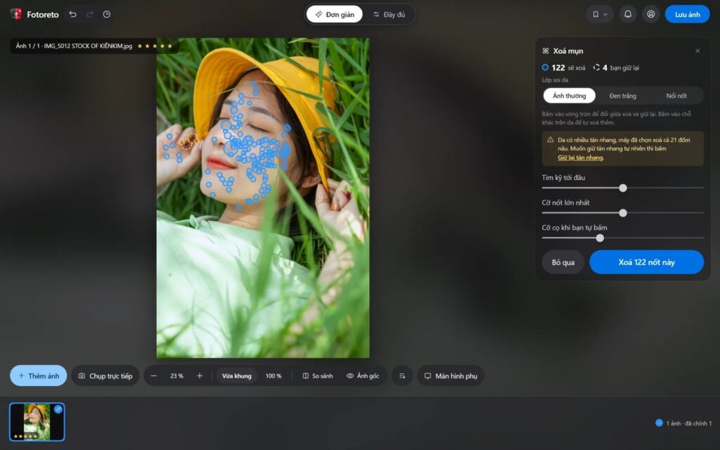 Thẻ Xoá mụn trong Fotoreto khoanh từng nốt mụn trên khuôn mặt