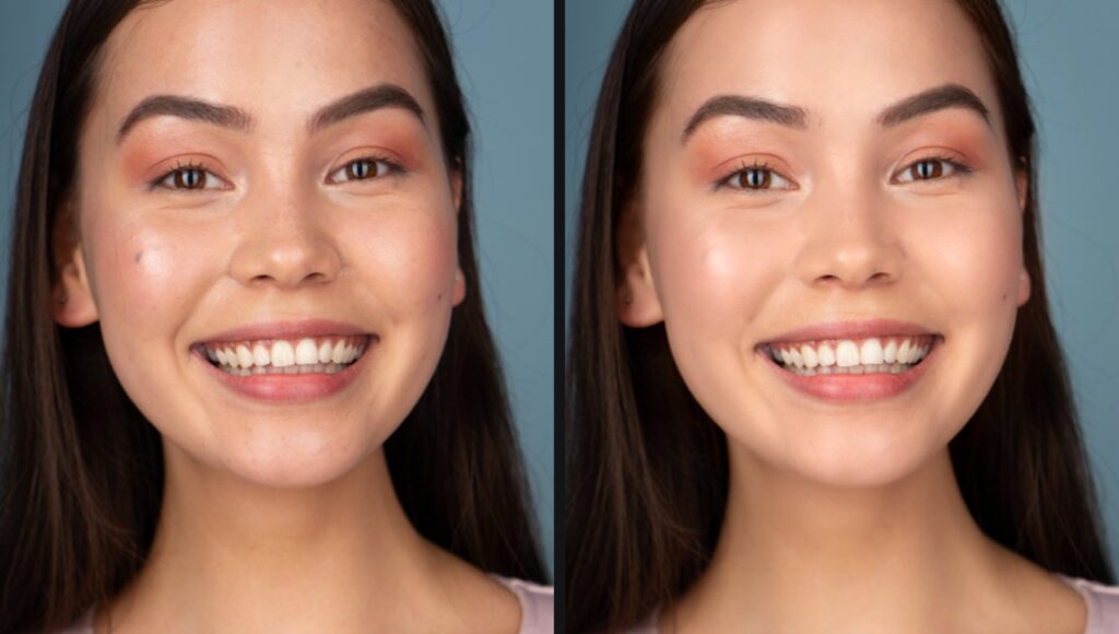 Ảnh chân dung cô gái đang cười trước và sau khi retouch bằng Fotoreto: xoá mụn, làm mịn da, đều màu da, trắng răng