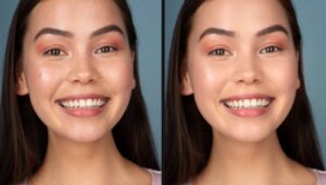 Ảnh chân dung cô gái đang cười trước và sau khi retouch bằng Fotoreto: xoá mụn, làm mịn da, đều màu da, trắng răng